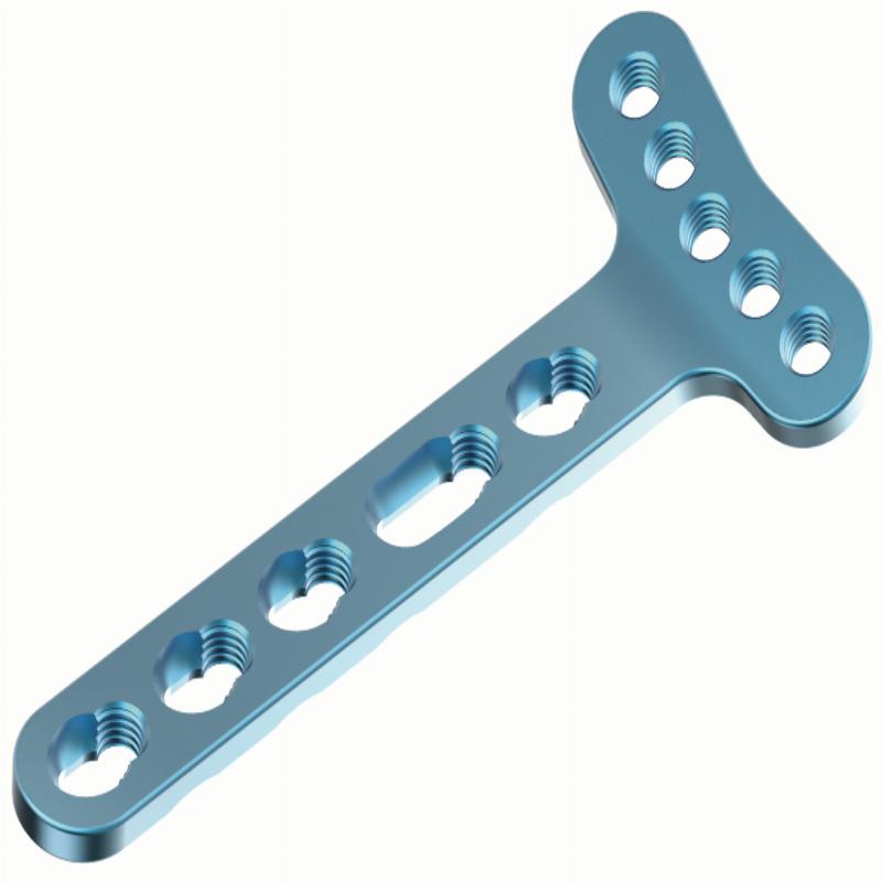 2.4мм Блокуючий дистальний долонний промінь пластина,позасуглобовий